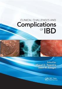 Clinical Challenges and Complications of IBD