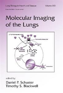 Molecular Imaging of the Lungs - Click Image to Close