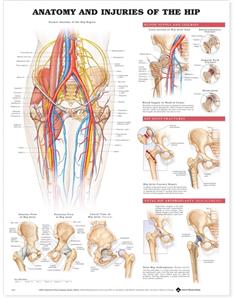Anatomy and Injuries of the Hip Anatomical Chart - Laminated