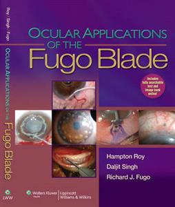 OCULAR APPLICATIONS OF FUGO BLADE