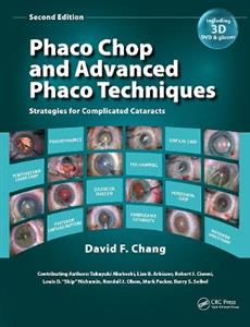 Phaco Chop and Advanced Phaco Techniques