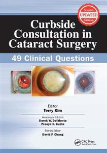 Curbside Consultation in Cataract Surgery