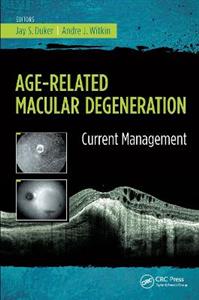 Age-Related Macular Degeneration - Click Image to Close