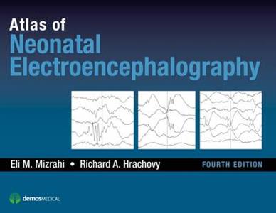Atlas of Neonatal Electroencephalography - Click Image to Close
