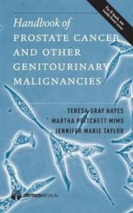 Handbook of Prostate Cancer and Other Genitourinary Malignancies - Click Image to Close