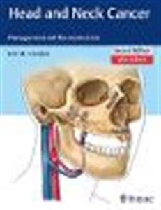 Head and Neck Cancer: Management and Reconstruction - Click Image to Close