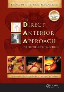 The Direct Anterior Approach to Hip Reconstruction - Click Image to Close