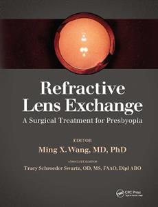 Refractive Lens Exchange - Click Image to Close