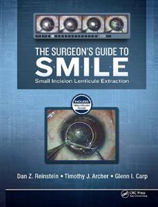 The Surgeon?s Guide to SMILE - Click Image to Close