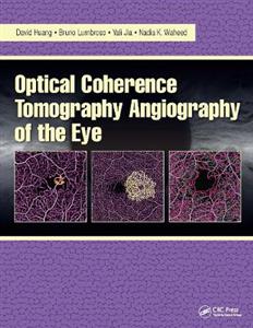 Optical Coherence Tomography Angiography of the Eye - Click Image to Close