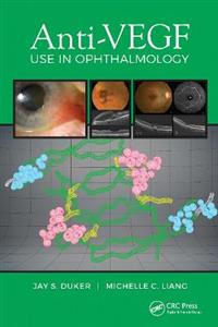 Anti-VEGF Use in Ophthalmology