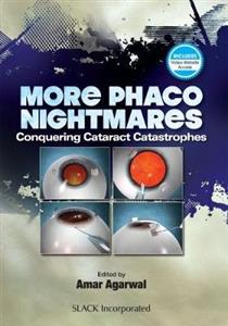 More Phaco Nightmares: Conquering Cataract Catastrophes
