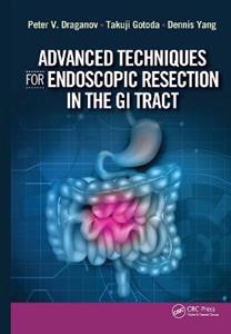 Advanced Techniques for Endoscopic Resection in the GI Tract - Click Image to Close