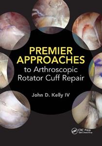 Premier Approaches to Arthroscopic Rotator Cuff Repair - Click Image to Close