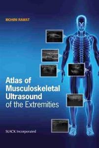Atlas of Musculoskeletal Ultrasound of the Extremities - Click Image to Close