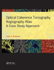 Optical Coherence Tomography Angiography Atlas