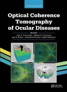 Optical Coherence Tomography of Ocular Diseases - Click Image to Close