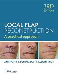 Local Flap Reconstruction - Click Image to Close