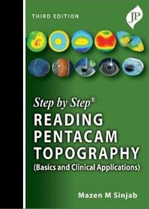 Step by Step: Reading Pentacam Topography