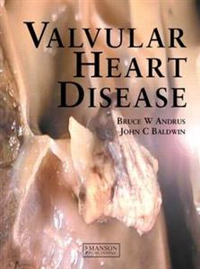 Valvular Heart Disease