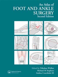 Atlas Foot and Ankle Surgery - Click Image to Close