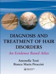 Diagnosis and Treatment of Hair Disorders - Click Image to Close