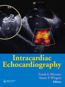 Intracardiac Echocardiography - Click Image to Close