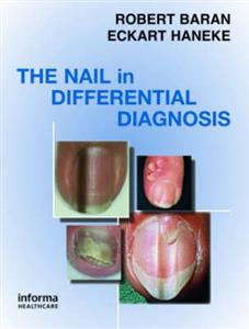 Nail in Differential Diagnosis