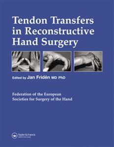 Tendon Transfers in Reconstructive Hand Surgery