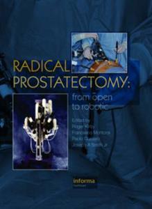 Radical Prostatectomy