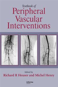 Textbook of Peripheral Vascular Interventions