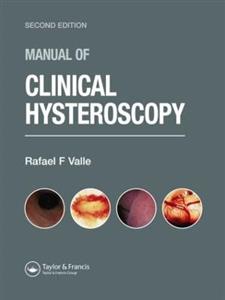 Manual of Clinical Hysteroscopy, Second Edition - Click Image to Close