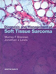 Diagnosis and Management of Soft Tissue Sarcoma