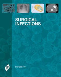 Surgical Infections