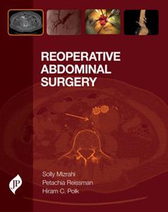 Reoperative Abdominal Surgery - Click Image to Close