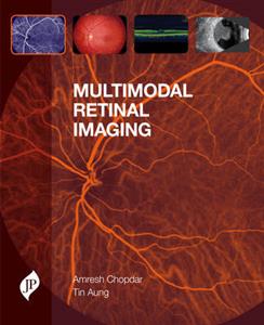 Multimodal Retinal Imaging