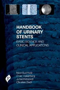 Handbook of Urinary Stents - Click Image to Close