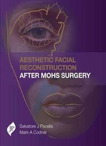 Aesthetic Facial Reconstruction After Mohs Surgery - Click Image to Close