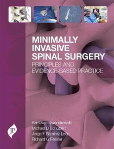 Minimally Invasive Spinal Surgery - Click Image to Close