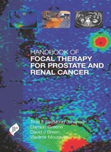 Handbook of Focal Therapy for Prostate and Renal Cancer - Click Image to Close