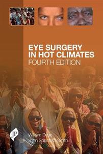 Eye Surgery in Hot Climates - Click Image to Close