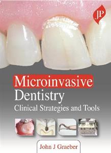 Microinvasive Dentistry - Click Image to Close