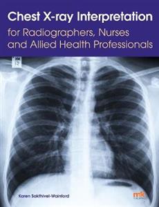 Chest X-ray Interpretation for Radiographers, Nurses and Allied Health Professionals - Click Image to Close