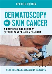 Dermatoscopy and Skin Cancer, updated edition: A handbook for hunters of skin cancer and melanoma