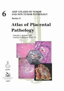 Atlas of Placental Pathology - Click Image to Close