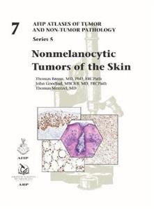 Nonmelanocytic Tumors of the Skin - Click Image to Close