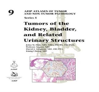 Tumors of the Kidney, Bladder, and Related Urinary Structures - Click Image to Close