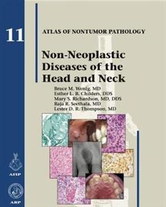 Non-Neoplastic Diseases of the Head and Neck - Click Image to Close