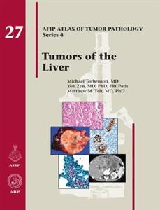Tumors of the Liver - Click Image to Close