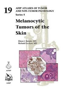 Melanocytic Tumors of Skin - Click Image to Close